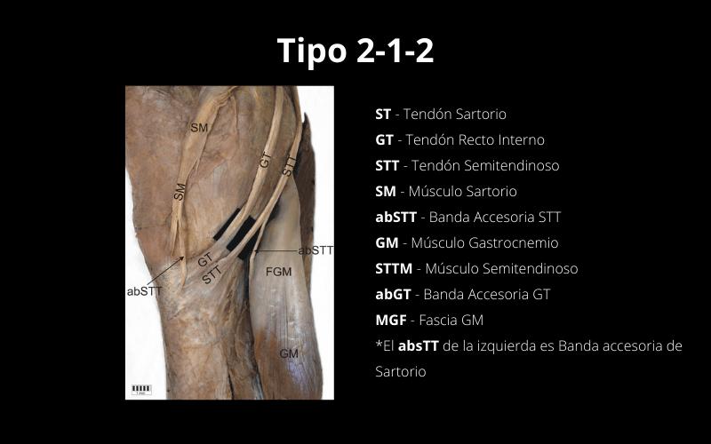 Tipo 212 Bursa Pes anserinus.png